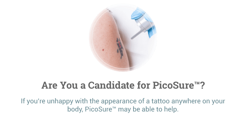 Best Laser Tattoo Removal with Picosure - Philadelphia & Main Line PA -  Find Pricing & Cost